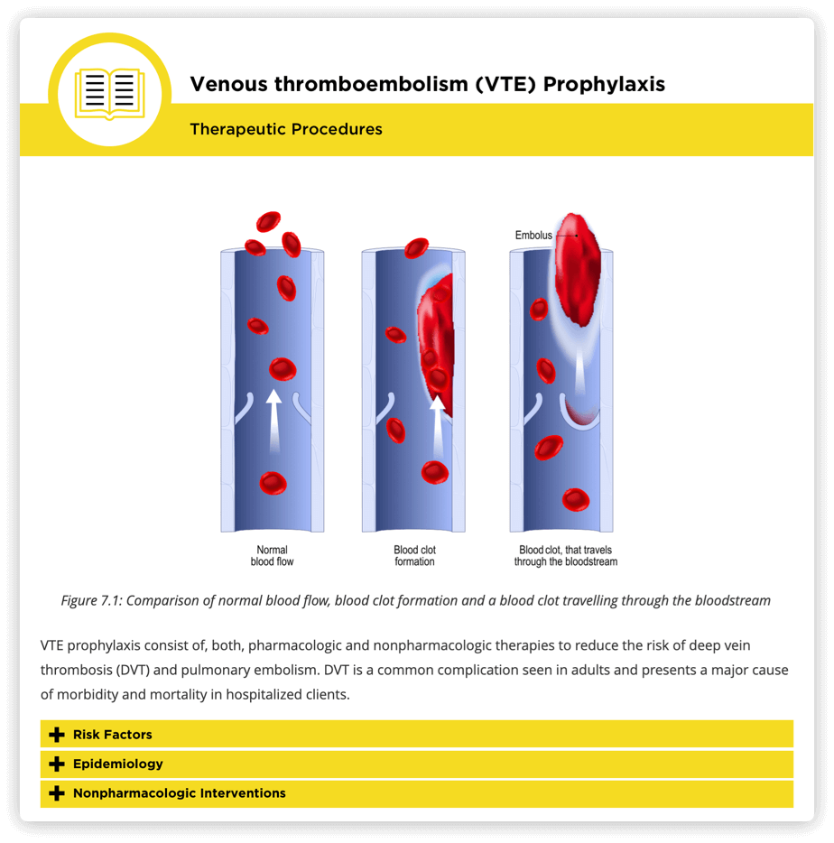 VTE Prophylaxis Picture